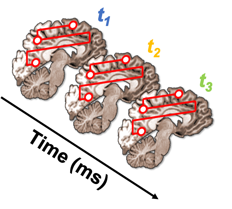 Cochlea to categories: The spatiotemporal dynamics of semantic auditory ...